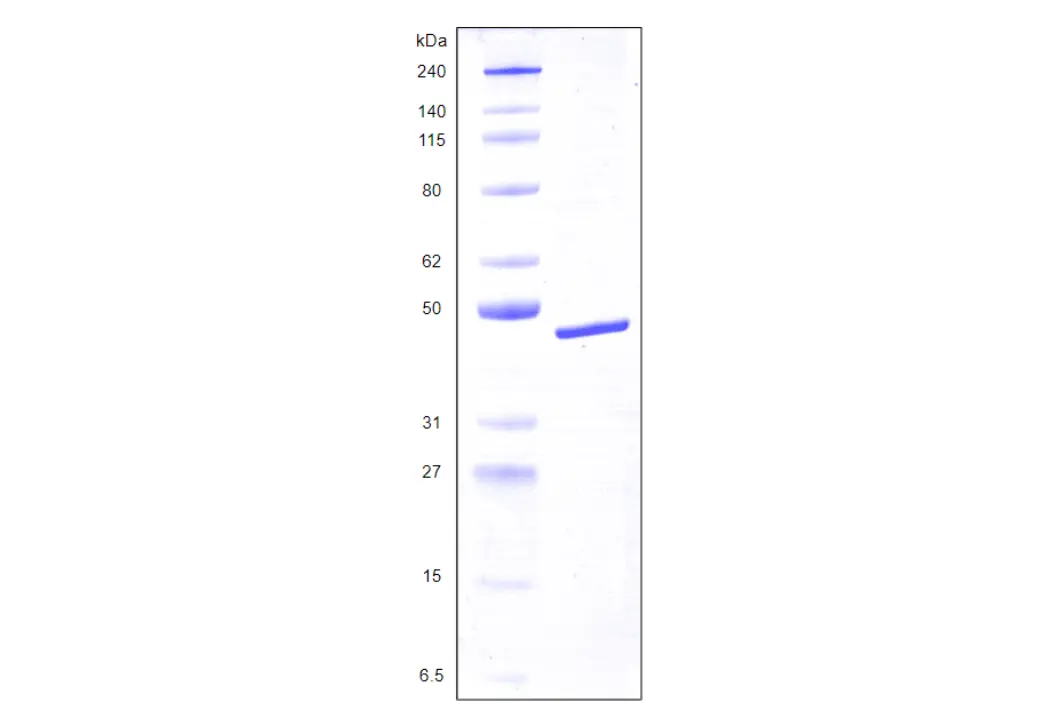 Recombinant Human Galectin 8, variant 2, His Tag (359 a.a.) -100 ug